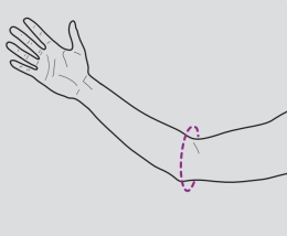 Orteza pentru incheietura mainii mana cot, fixa