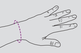 Orteza pentru incheietura mainii mana, fixa TRIACARP 2