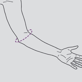 Orteza de cot epicondilita