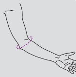 Orteza de cot simpla 