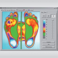 Amprentarea plantara computerizata